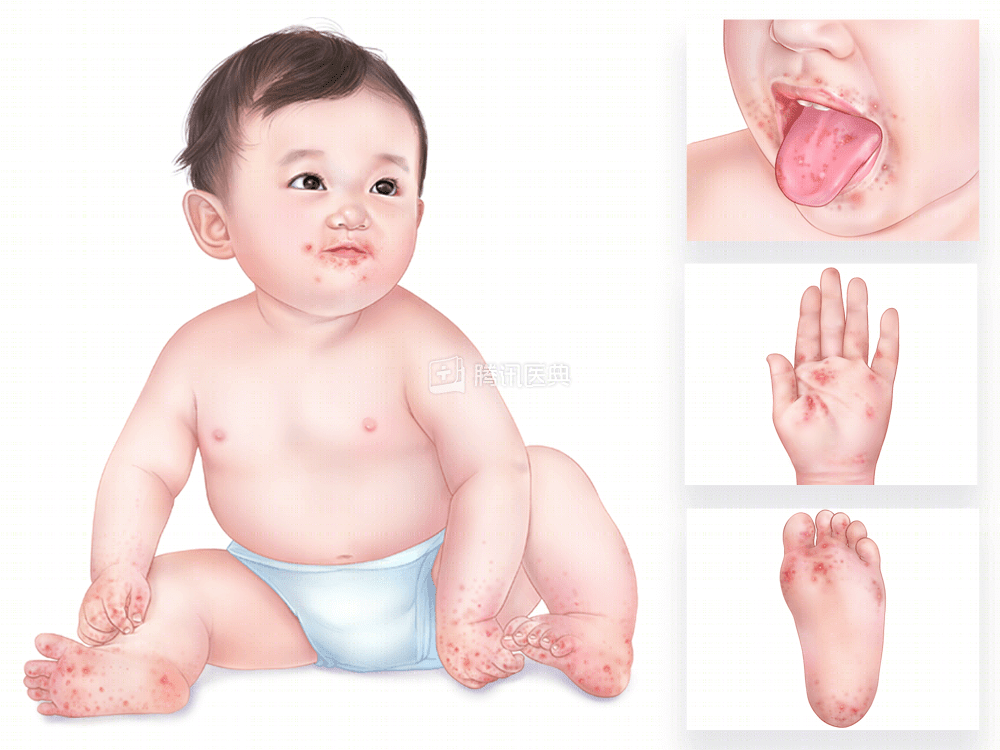 4c5fe4b8931a802dc510c0a0476b1b1c.png
